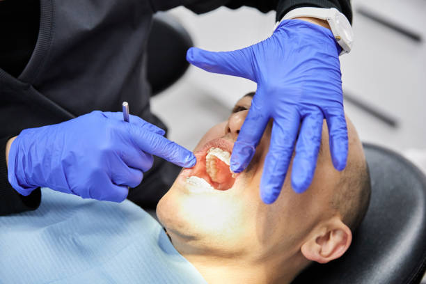 Best Broken Tooth Emergency  in Lake City, PA